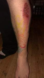 TATTOOSDAY #26 - JAKE'S ROAD RASH