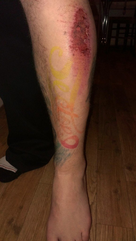 TATTOOSDAY #26 - JAKE'S ROAD RASH